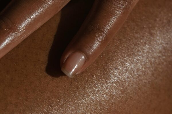 Winter Dryness: Simple Habits To Save Your Skin