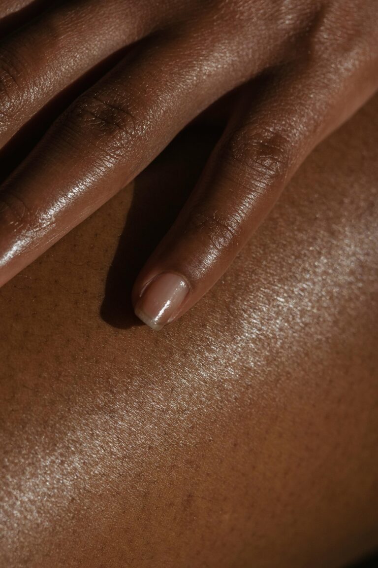 Winter Dryness: Simple Habits To Save Your Skin